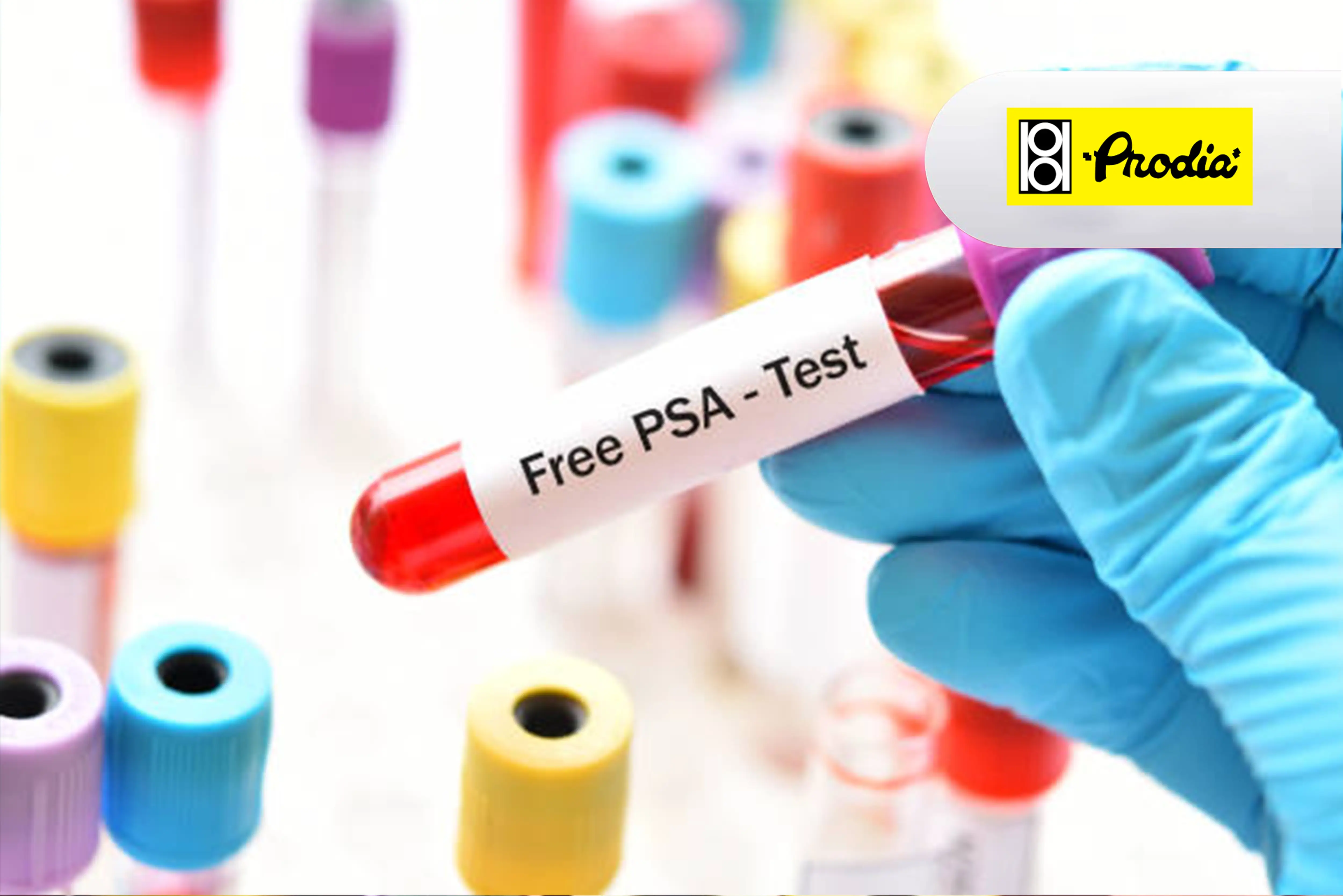 https://api.oneonco.co.id/storage/photo/product/Prodia-FREE PSA TEST_1726201889.webp